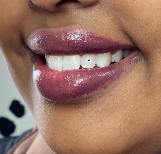 Tooth gems are back on trend and here to stay